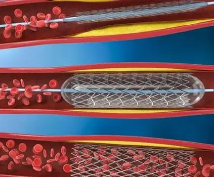 About Ascenza Global Infra Care