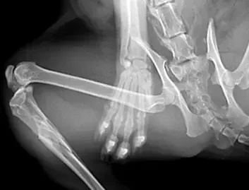 Polytrauma and Complex Trauma Surgeries