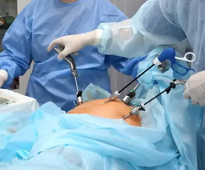 Minimally Invasive Surgery for Acute Pancreatitis