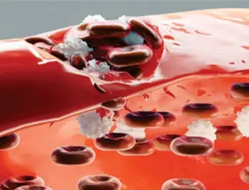 Trauma with Vascular Injuries