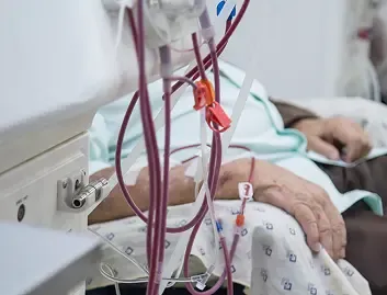 Dialysis Access